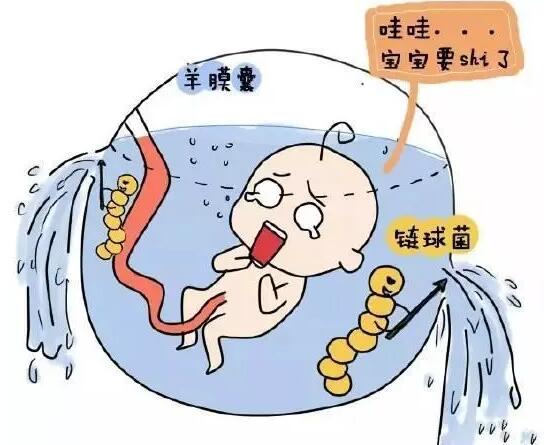 什么是期破孕期破水？高位破水的5大明显特征