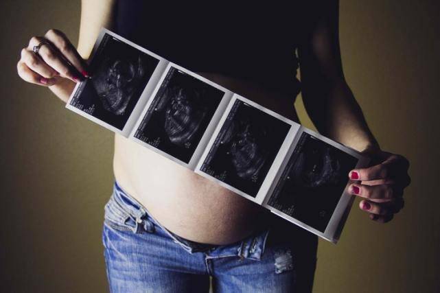 怀孕晚期,如何判断＂要生了＂？3个方法要牢记,别把孩子生家里