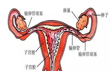 输卵管之母：给不孕女性留下“生”机！
