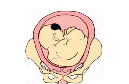 什么是胎儿入盆？感觉是什么样的？胎儿入盆后的注意事项