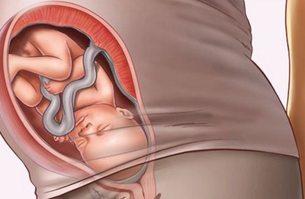 快到临产期，胎儿还没有入盆是怎么回事？