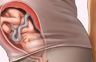 胎宝宝入盆就是要生了？怎样判断胎儿是否入盆了？