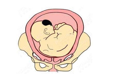 胎头位于下腹部是什么意思 不要盲目揣测