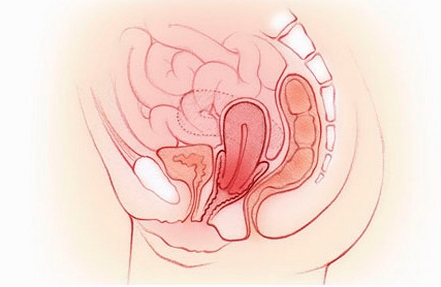 子宫脱垂都有哪些症状？产后子宫脱垂怎么办？