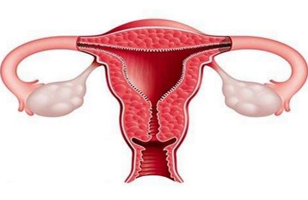子宫内膜增生可以做试管婴儿吗？