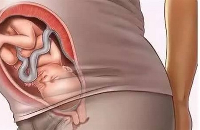 胎儿入盆了吗？胎儿入盆有啥感觉？