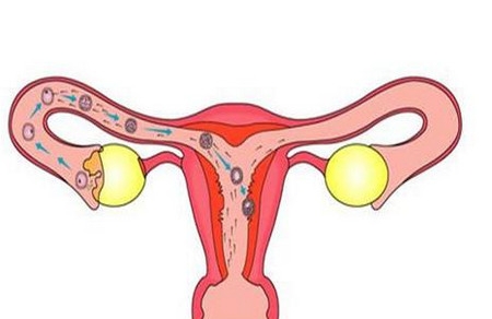 自检输卵管，预防输卵管疾病