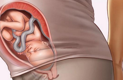 胎儿多少周入盆 胎儿入盆注意事项