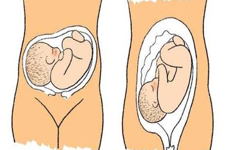 胎儿头位低是什么原因 胎儿头位偏低原因大揭秘
