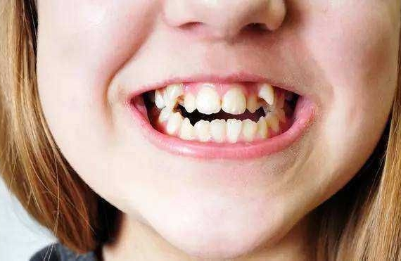 孩子牙齿黄是什么原因