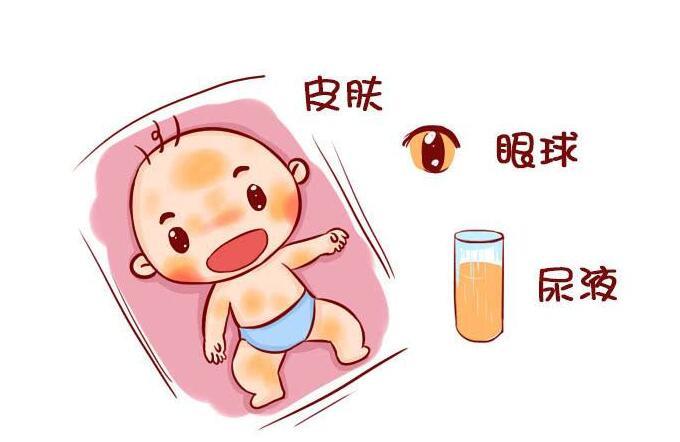 新生儿生理性黄疸的症状