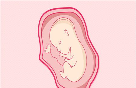胎儿脉络丛囊肿吃什么可以让胎吸收