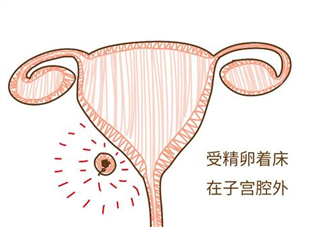 怀孕期间没补钙会影响胎儿吗 孕期需要补钙吗