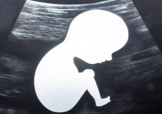 孕妇过早显怀的原因 孕肚大胎儿就大吗
