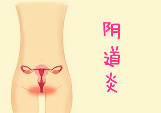 不同类型阴道炎症状有什么不同 女性得了阴道炎该怎么办