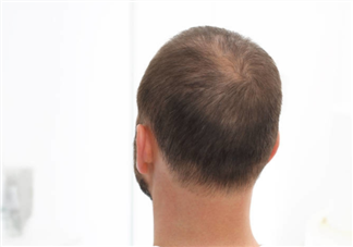 毛囊闭合还可以长出头发吗 判断毛囊健康的方法