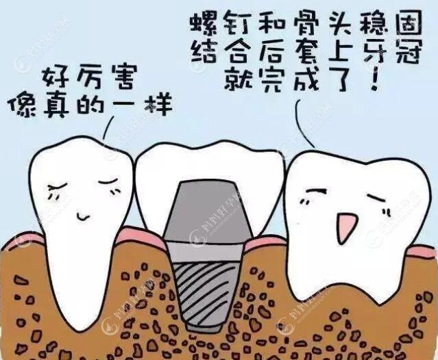 种植牙和真牙的使用感觉能一样吗