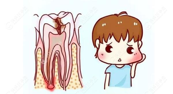 儿童根管治疗后会影响以后长牙吗