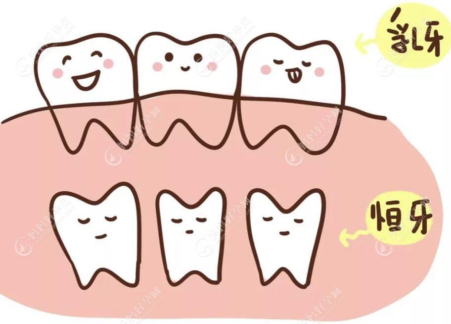 乳牙根管治疗会影响恒牙吗?担心小朋友根管治疗后影响换牙