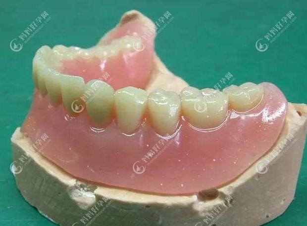 目前最先进的活动义齿有覆盖性义齿/吸附性义齿/纯钛假牙…
