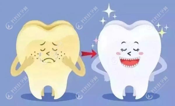 不正规操作及不良贴面材料容易对牙齿造成伤害