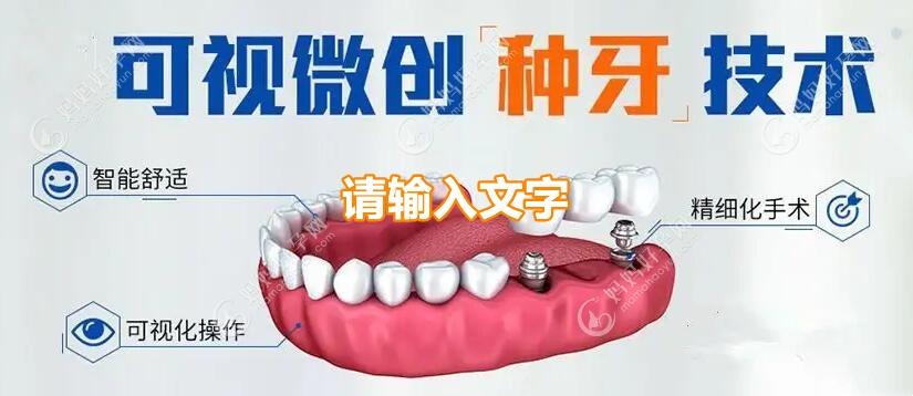 微创种牙技术