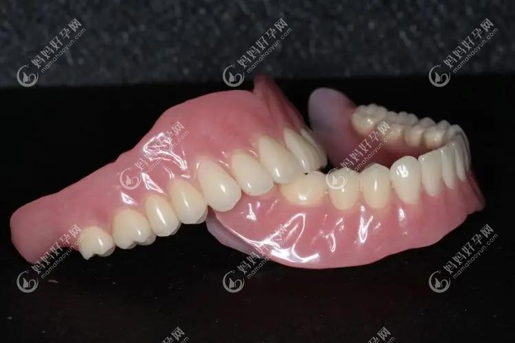 仿生牙和种植牙有啥不同?想看无种植仿生牙怎么固定的视频
