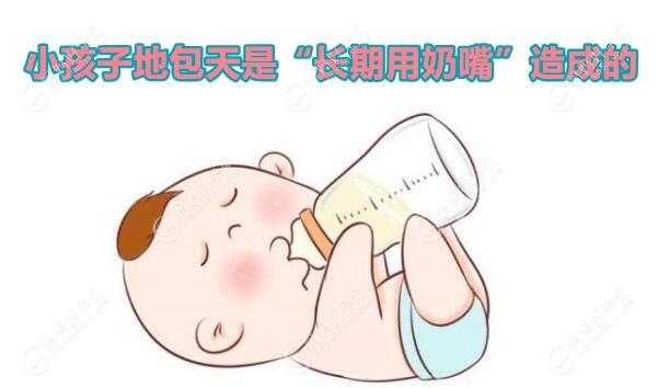 小孩子地包天是长期用奶嘴引起的,避免用奶瓶诱导儿童入睡