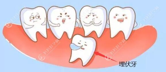 宝妈们来看~导致3-7岁儿童乳牙牙缝大的原因有哪些