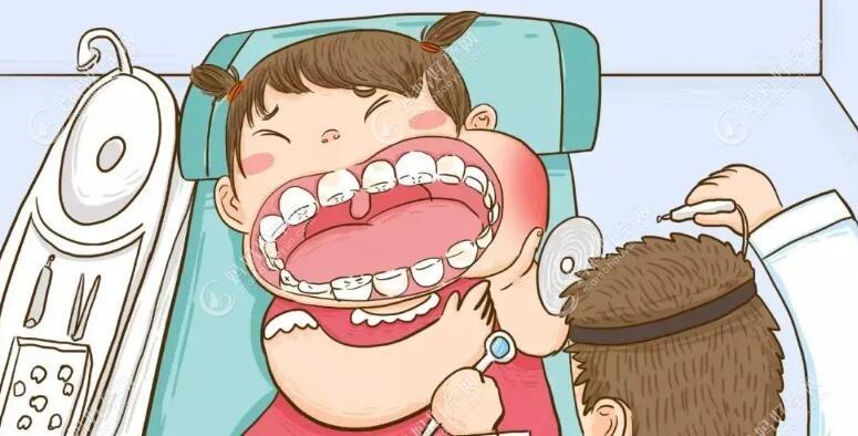 科普儿童牙齿护理六大知识：其涂氟是有效预防龋齿的方法