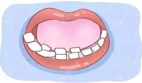 牙齿磕歪复位的较佳时间