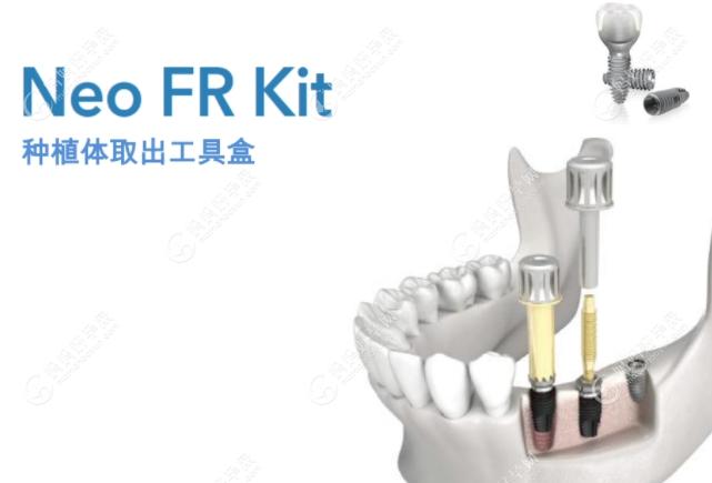 韩国进口种植牙品牌有哪几种登腾才第三那排前五的植体