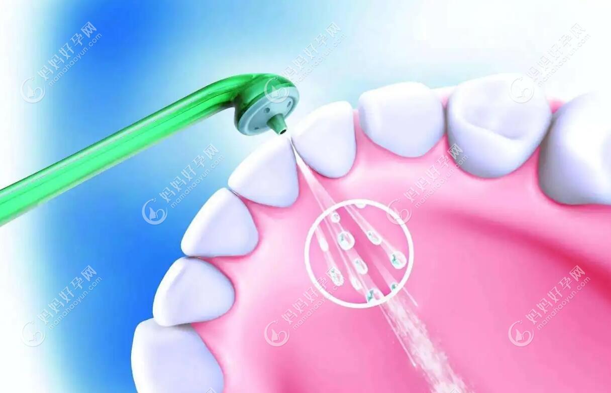 3-12岁的儿童不仅能洗牙,还是清除牙垢预防蛀牙的好方法呢