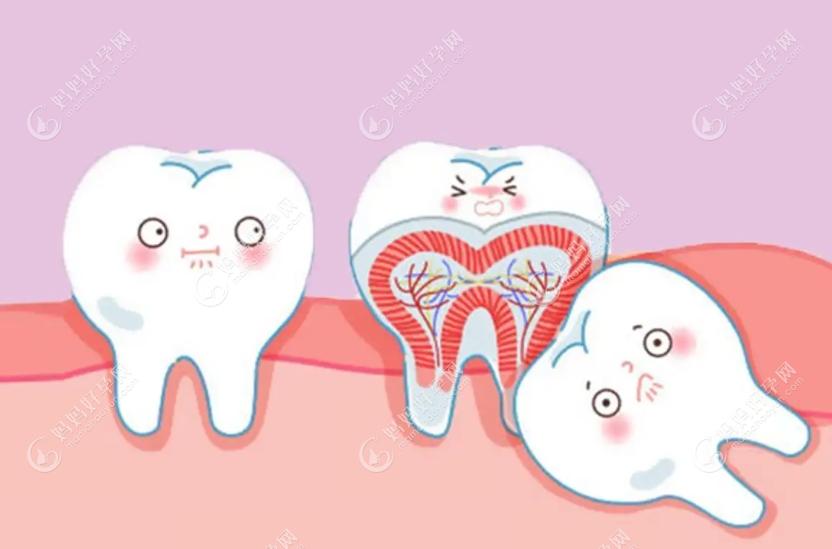 牙齿来矫正不会破坏原有的牙体组织