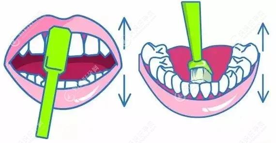 刷前牙内侧面时可以把牙刷竖起