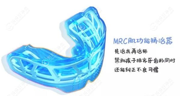 MRC儿童牙齿矫正器的原理