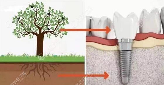 种牙骨粉骨膜=树苗和土壤相结合
