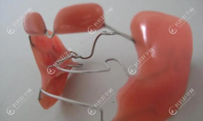 那防止咬下唇的这个唇挡矫正器究竟有用吗?