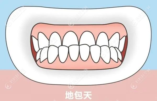 牙齿矫正是换牙前还是换牙后比较好