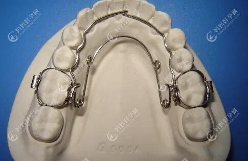 慢速扩弓之四眼圈簧扩弓器