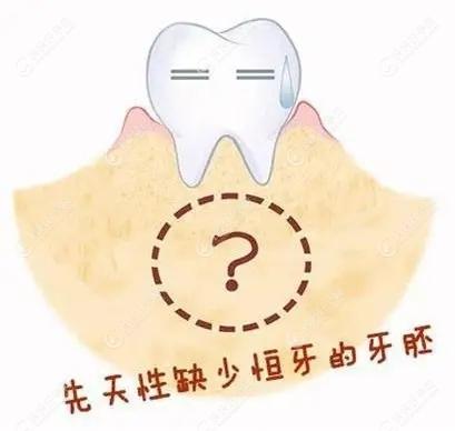 先天牙胚缺失就会影响恒牙长出