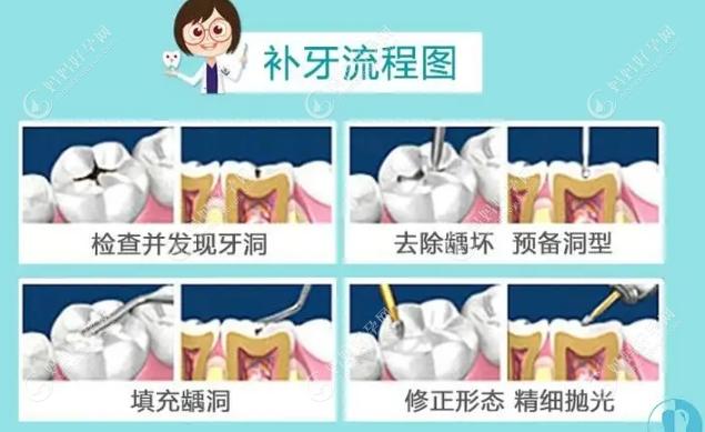 补牙的过程图