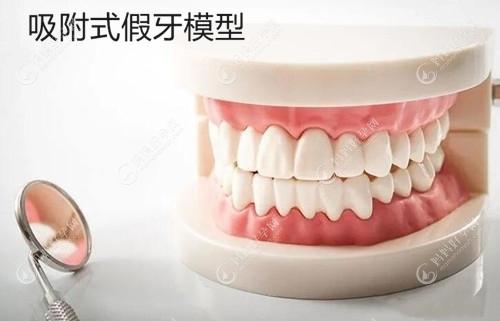 老人无牙牙龈萎缩吸附式假牙就不错
