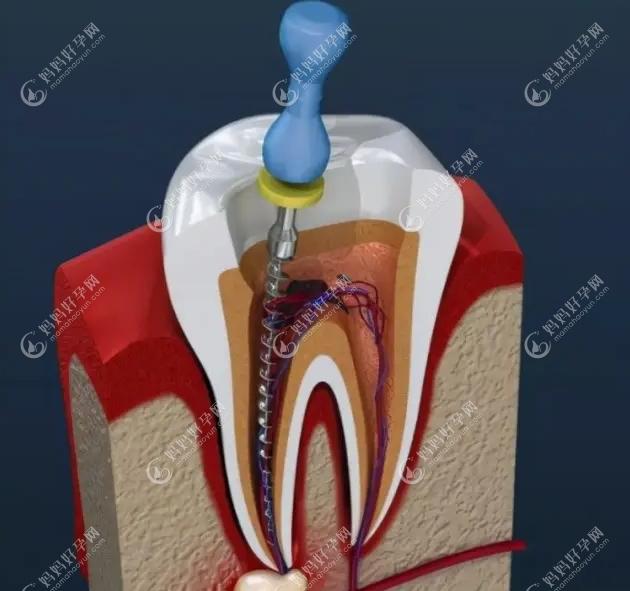 医生操作不当导致牙齿损伤