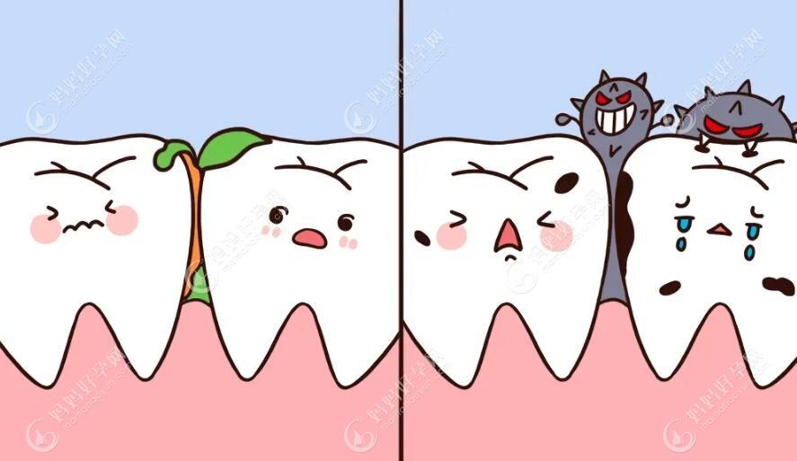 牙齿龋坏怎么办mamahaoyun.com