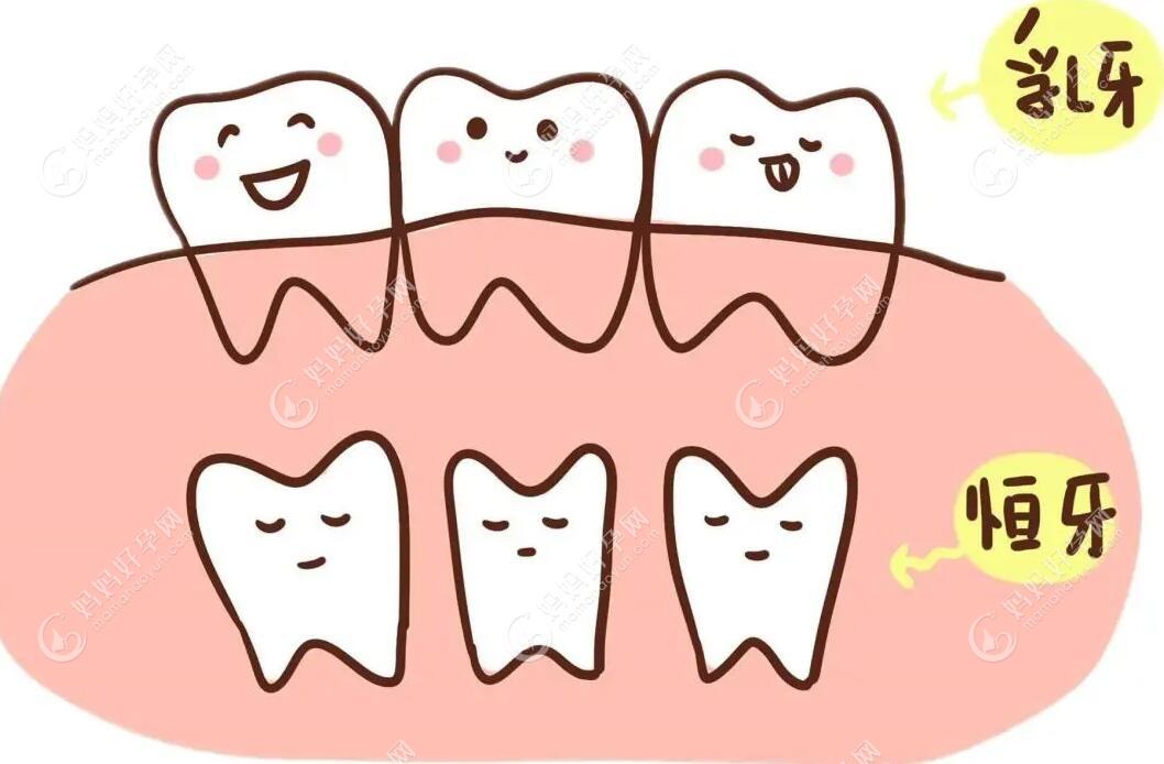 儿童乳牙龋齿补牙后会影响换牙吗?不仅不影响还有益无害!