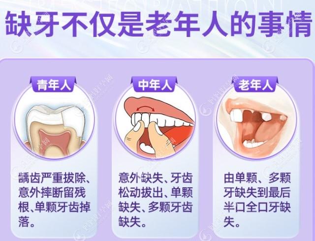 牙齿缺失症状