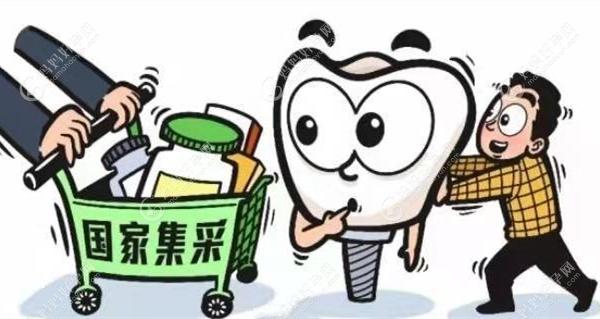 安徽蚌埠种植牙集采已开始实行,种植牙限价至1800-2200元一颗