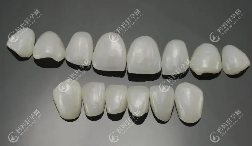 瓷贴面是一种美白牙齿的技术