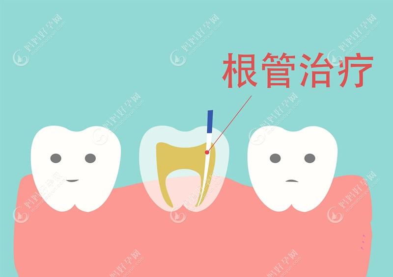 换牙前有必要根管治疗吗?乳牙不做根管治疗会不会影响换牙